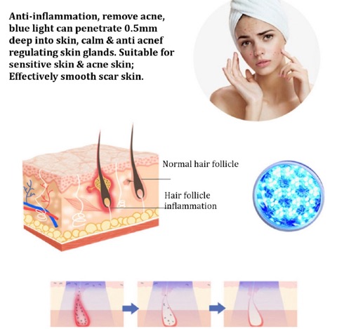 ٻҾ3 ͧԹ : ͧǴ˹õ͹ LED ¹ǹǴ Ẻʧ 4  ҹù͡ Beauty Inside Photon LED Bio-Wave Skin Care System Set