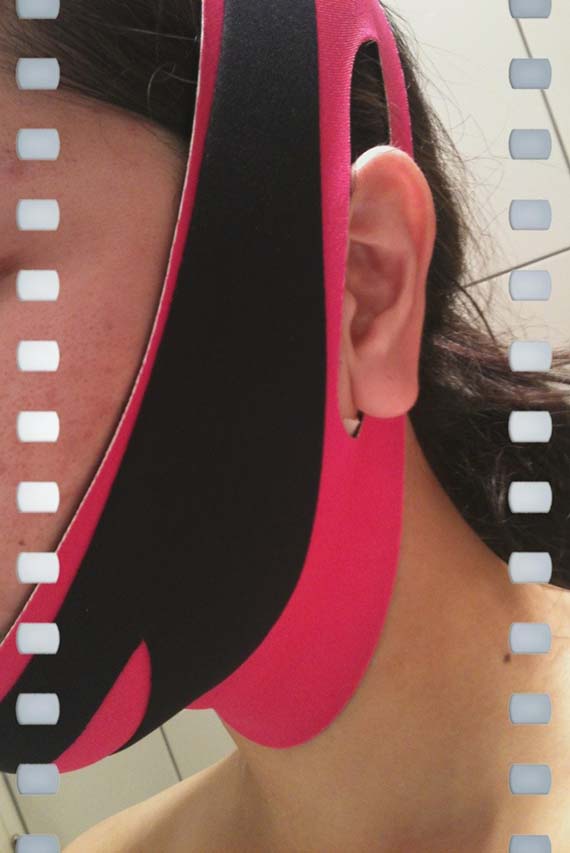 ٻҾ5 ͧԹ : Ѵ!˹ҡҡѴ˹ Ѻٻ˹Ẻ V shape Ẻ V Fit facial slimming mask