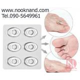 เจลซิลิโคนติดรองเท้าลดอาการบาดเจ็บบริเวณเท้าเฉพาะที่ เจลซิลิโคนติดรองเท้าลดอาการบาดเจ็บบริเวณเท้าเฉพาะที่