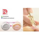 อุปกรณ์แก้ไขเล็บขบ  รุ่นนี้ใช้ได้ทั้งเล็บมือเล็บเท้าปรับขนาดได้ อุปกรณ์แก้ไขเล็บขบ  รุ่นนี้ใช้ได้ทั้งเล็บมือเล็บเท้าปรับขนาดได้